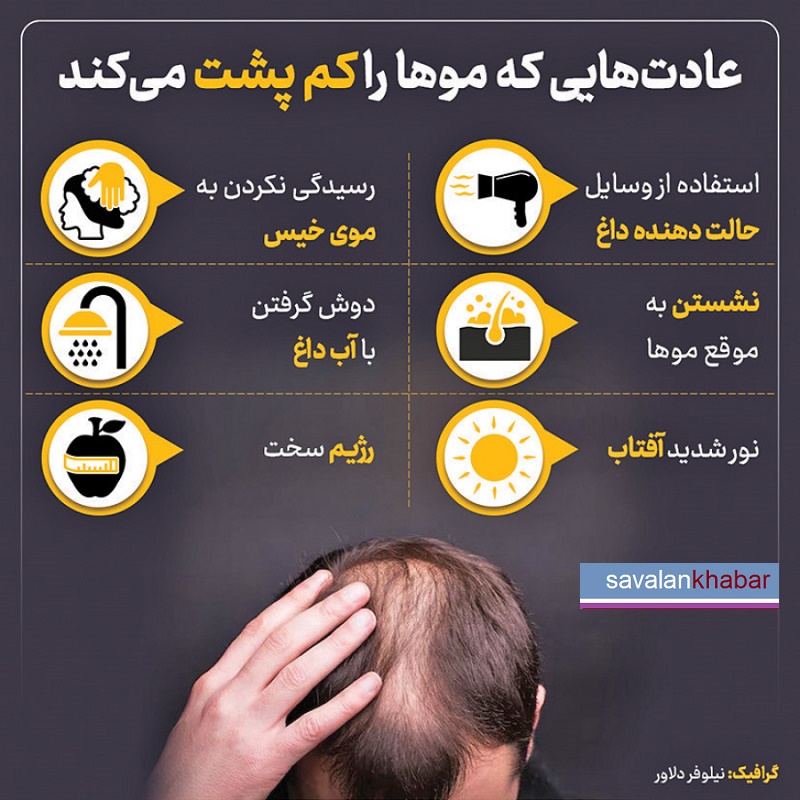 ریزش مو
